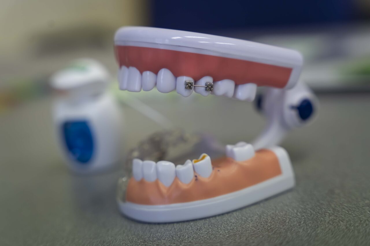 https://orto-dent.com.pl/wp-content/uploads/2024/07/DSC06958-1280x853.jpg